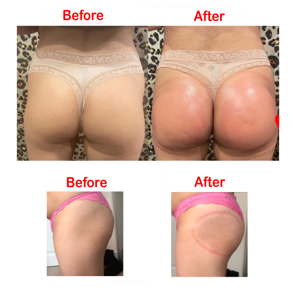 Vamsluna-臀部エンハンサー,2ピース,21 cmの拡 - Breast Pump のレビューと価格